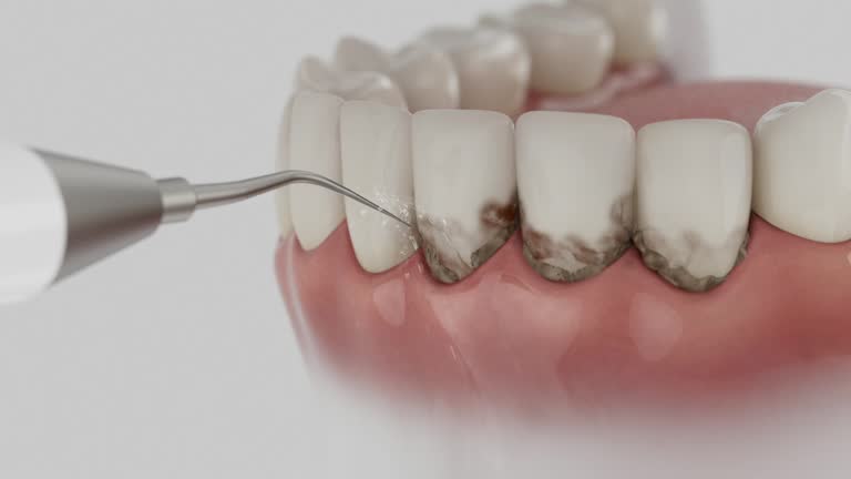 Reliable Dental Implants contractor in San Jacinto, CA by Smile Center Dentistry